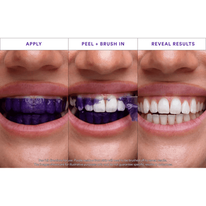 Purple Strips